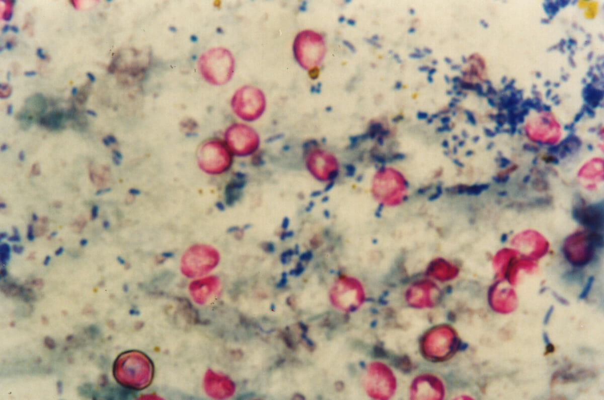 Microscopy-of-Cryptosporidium-parvum-1200x794_1.jpg